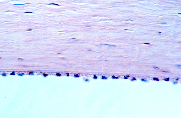  eye, Descemet's membrane 