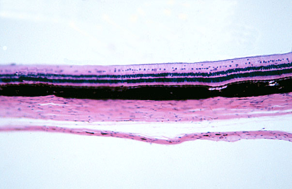  eye, sclera 