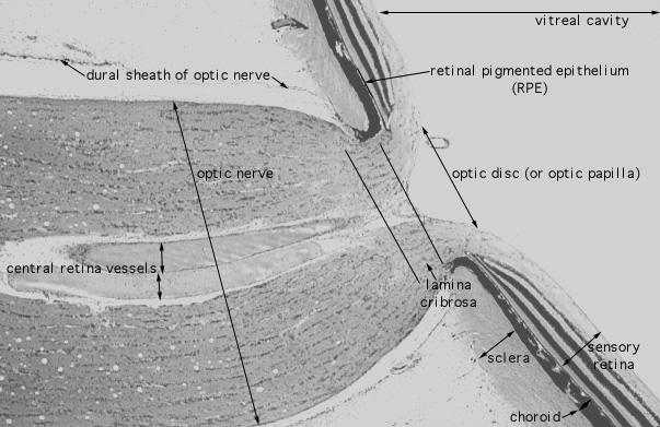  eye, lamina cribrosa 