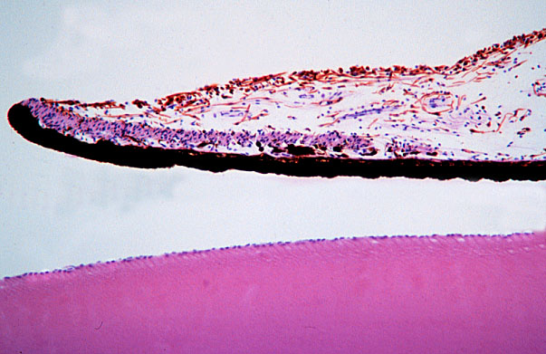  eye, sphincter pupillae 