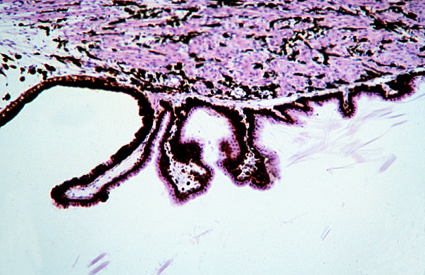  eye, ciliary muscle and body 