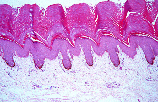  pigmented skin 