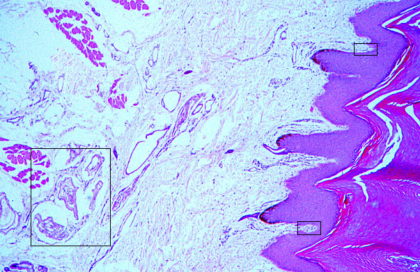  pigmented skin, Paccinian and Meissner's corpuscles 
