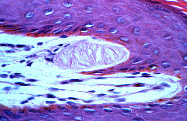  pigmented skin, Meissner's corpuscles 