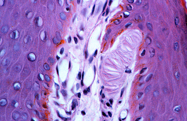  pigmented skin, Meissner's corpuscles 