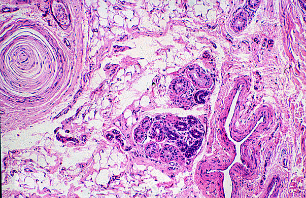  pigmented skin, Paccinian corpuscles 