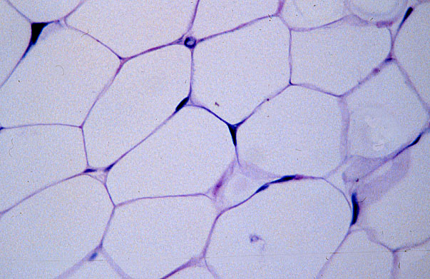  unilocular (white) adipocytes 