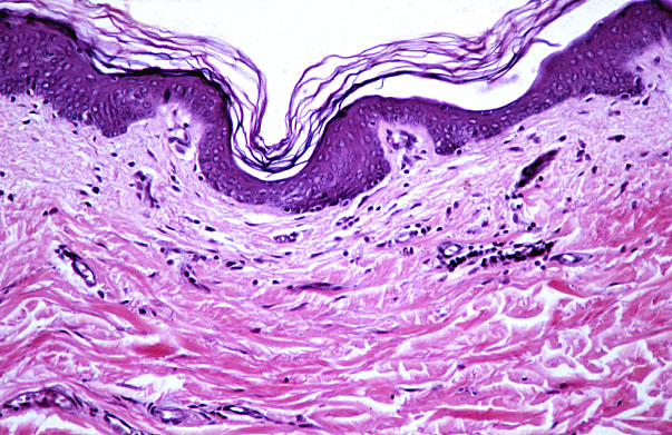  reticular dermis, papillary dermis 
