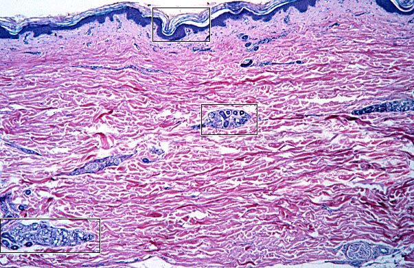  reticular dermis, papillary dermis 