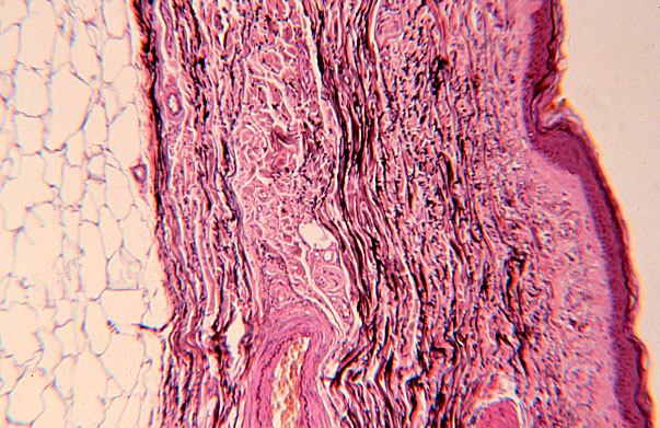  dermis, hypodermis, epidermis 