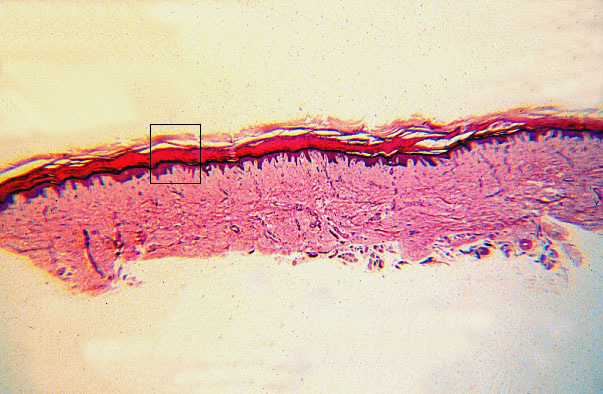  stratified squamous, keratinized epithelium 