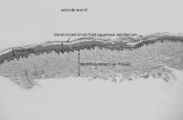  stratified squamous, keratinized epithelium 