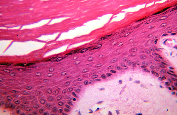  stratified squamous, keratinized epithelium 