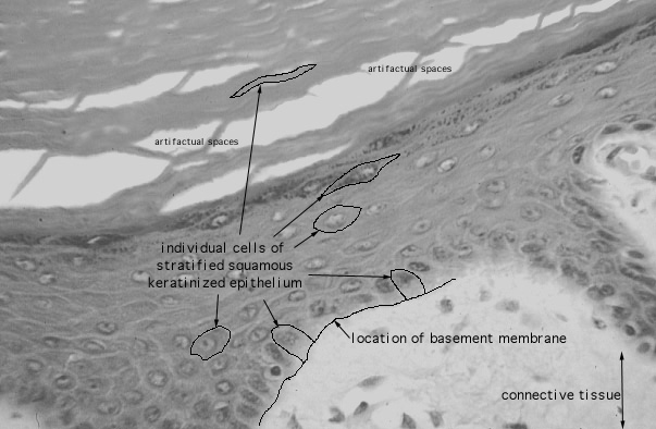  stratified squamous, keratinized epithelium 