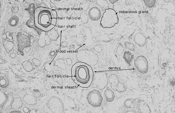  scalp, transverse, dermis level 