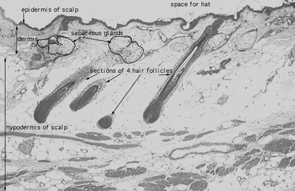  scalp 