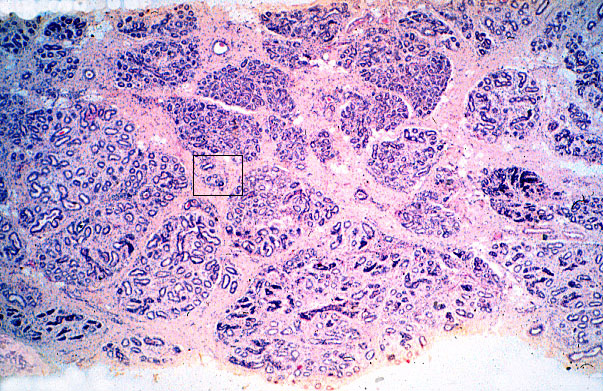  dense/loose irregular connective tissue 