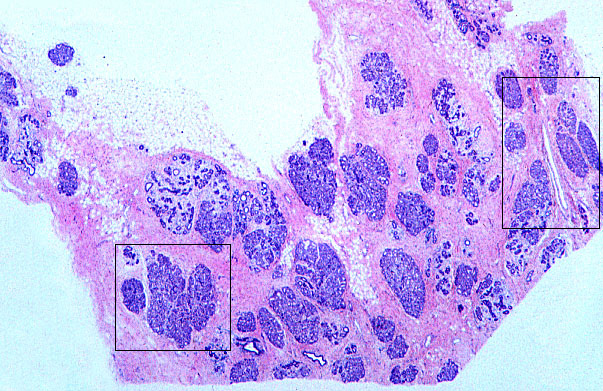  mammary gland, pregnancy 