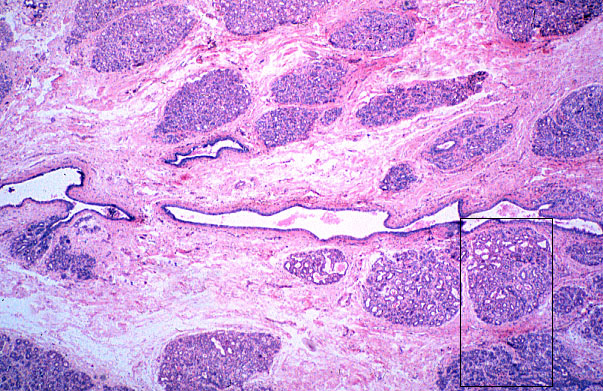  mammary gland, pregnancy, duct 