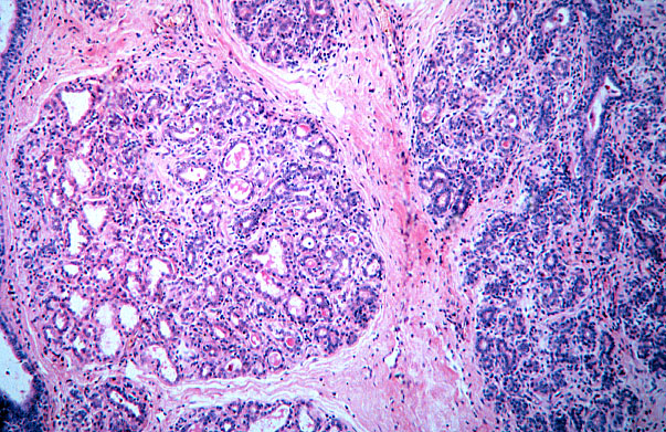  mammary gland, pregnancy, alveoli 