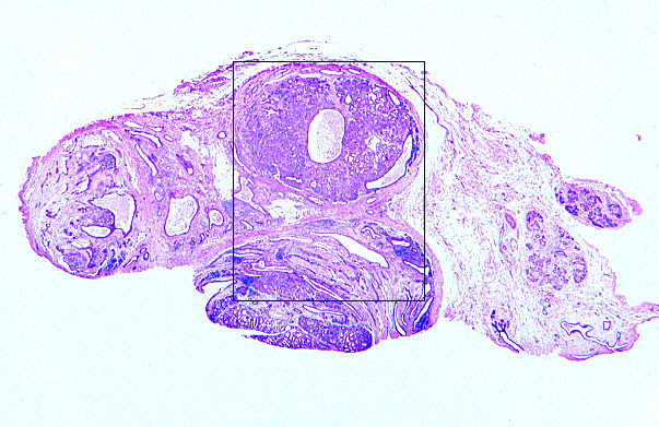  mammary gland, lobes 
