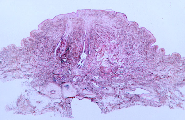  nipple, female 