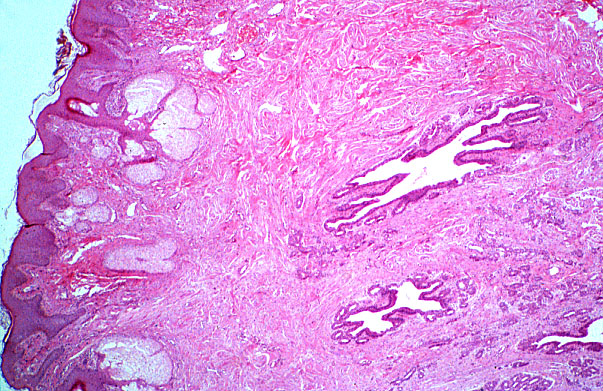  nipple, female, lactiferous ducts 