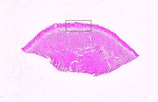 tongue, filiform, and fungiform papillae 