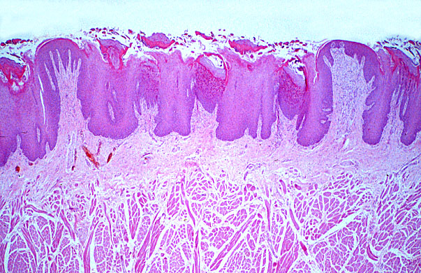  tongue, fungiform papillae 