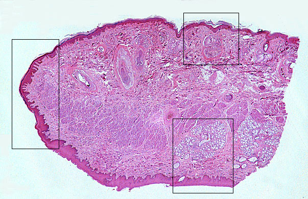  lip, oral mucosa 