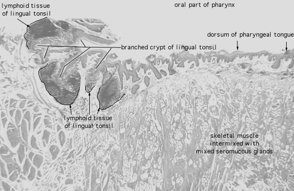  lingual tonsil 