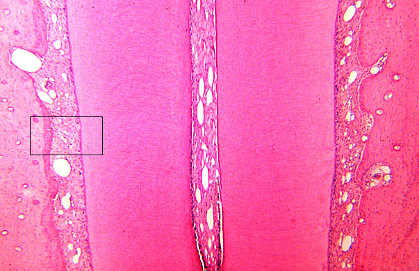  mature tooth, root 
