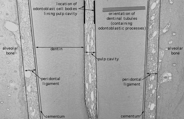  mature tooth, root 