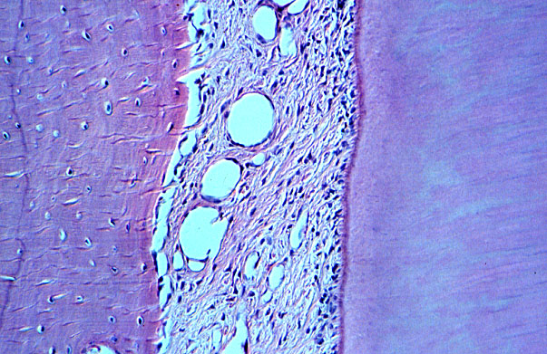  mature tooth, Sharpey's fibers 