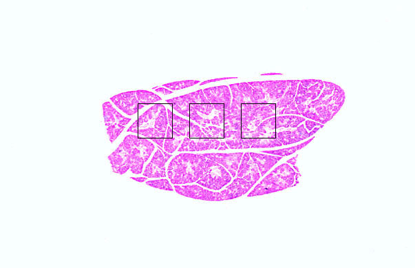 mixed serous/mucous gland 