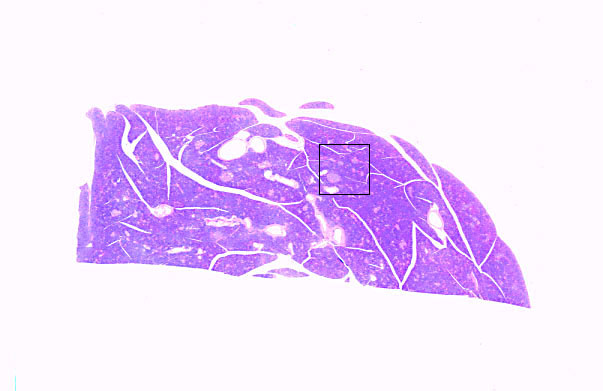  pancreas 