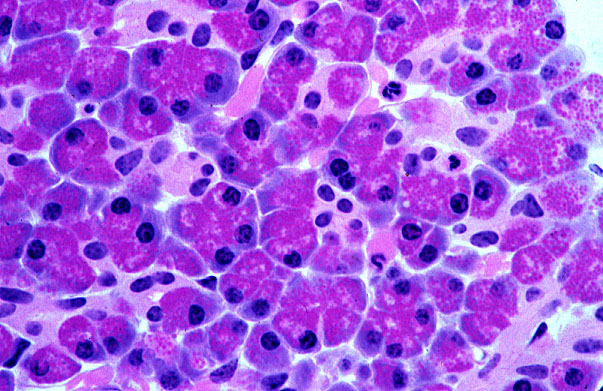  pancreas, centroacinar cells 