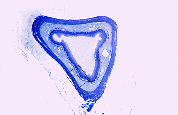 mid/esophagus 
