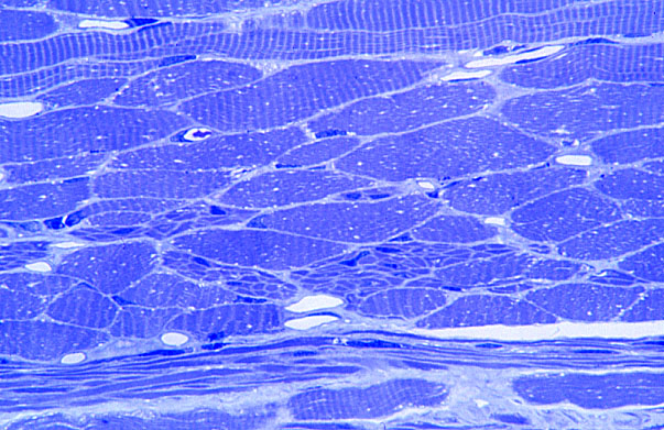  skeletal and smooth muscle fibers 