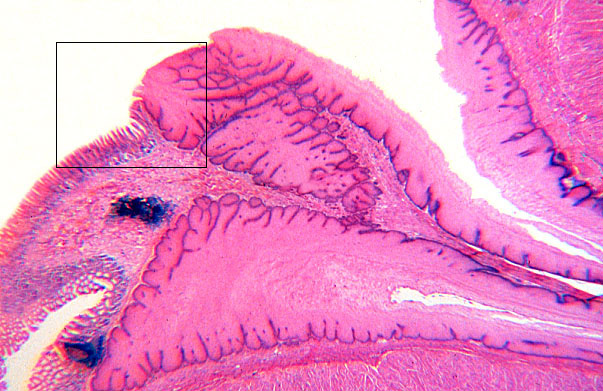  esophageal/stomach junction 