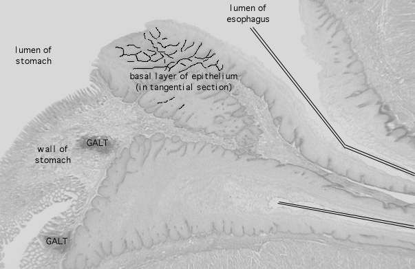  esophageal/stomach junction 