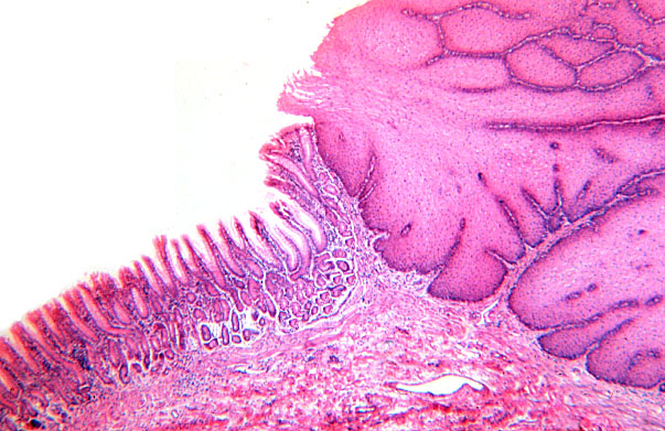  esophageal/stomach junction 