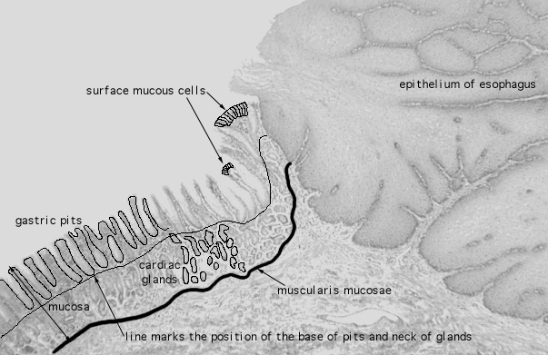  esophageal/stomach junction 