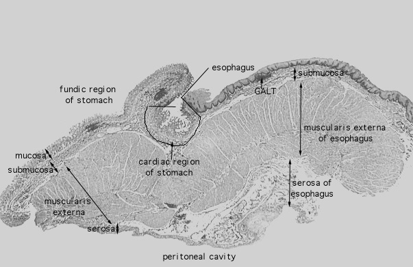  esophageal/stomach junction II 