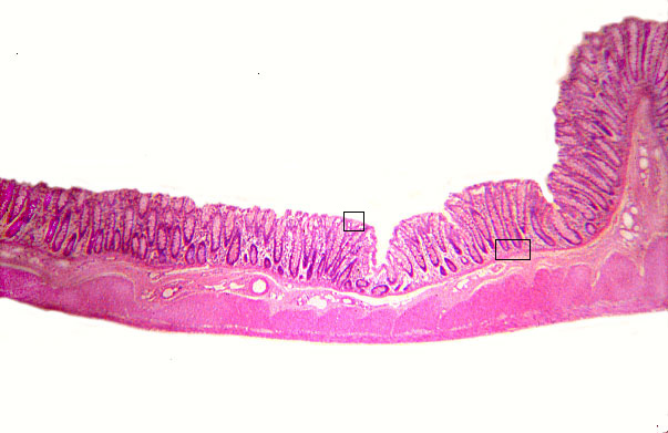  colon 