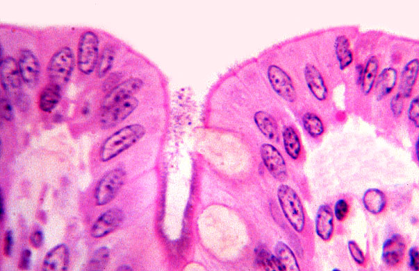  colon, luminal epithelia 