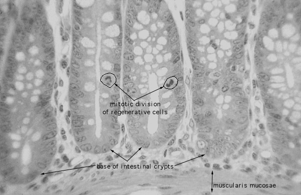  colon, mitotic figures 