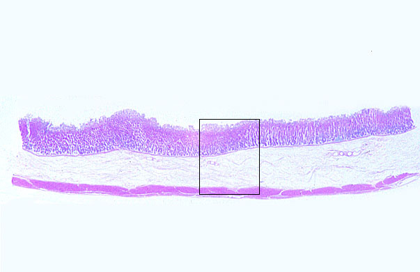  fundic stomach 