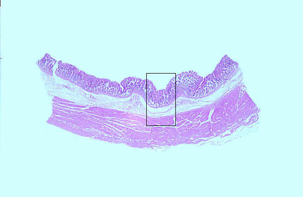  pyloric stomach 