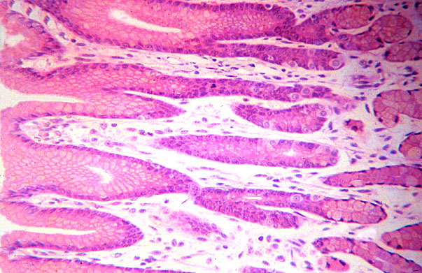  pyloric stomach, glands, lumen 